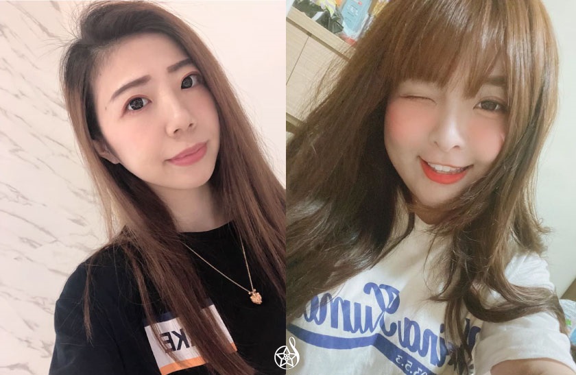 聽說做雷射的好時機在秋冬？雷射療程五花八門，又該如何選擇呢？